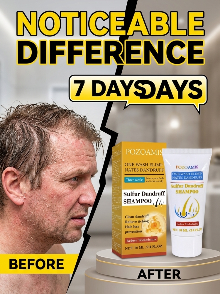 Hair Care Daily Routine - Günlük Kullanım İçin Kükürt İçeren Saç