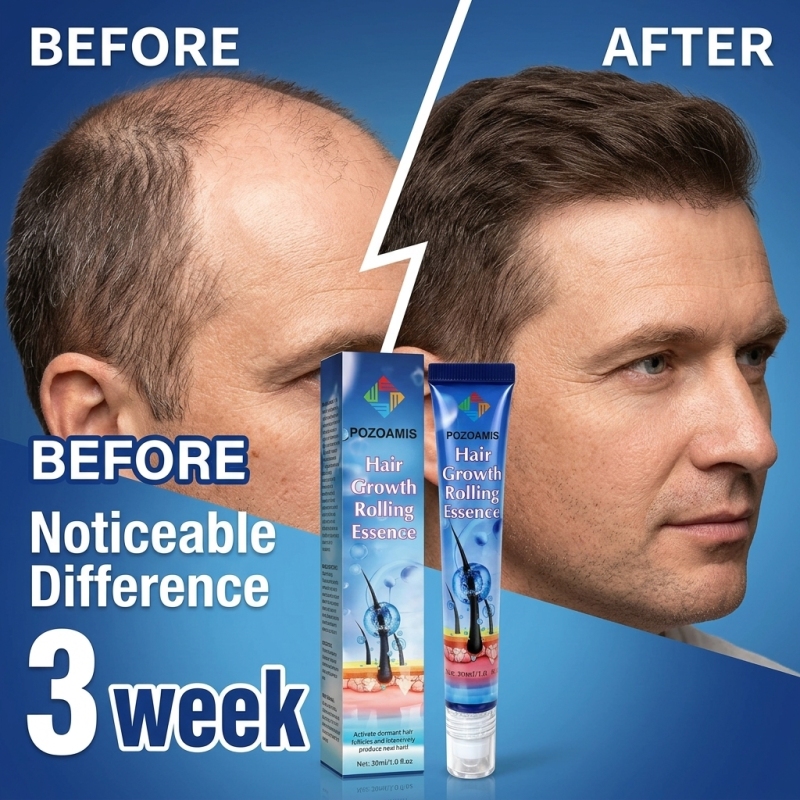 Hair Care Daily Routine - Taşınabilir Rulo Toplu Saç Derisi Besleyici