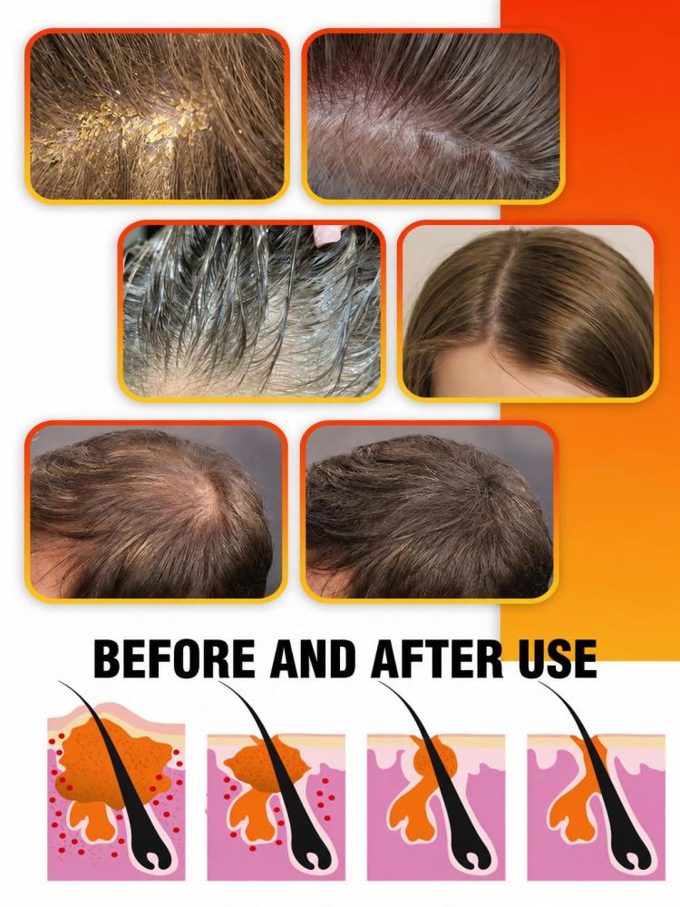 Günlük Kullanım İçin Kükürt İç - Hair Care Daily Routine incelemesi ve fiyatı